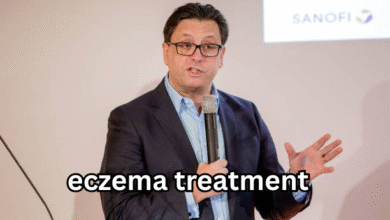 eczema treatment