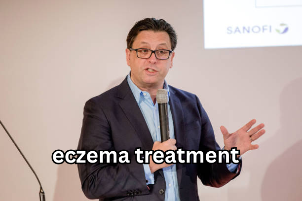 eczema treatment